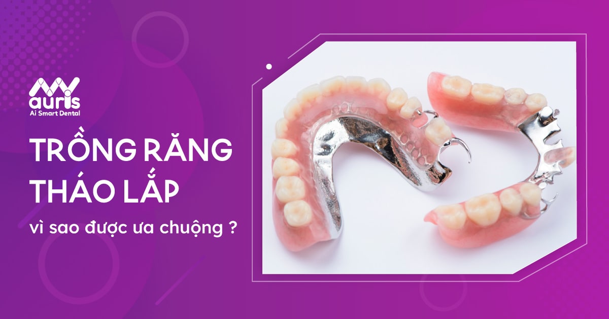 Trồng hàm răng tháo lắp là gì?