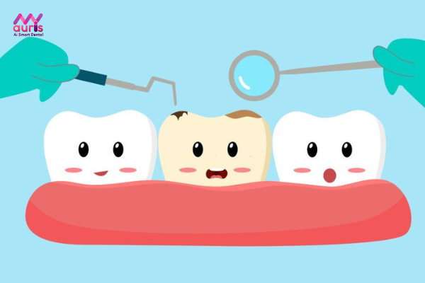 Mọc răng khôn có nguy hiểm không? 