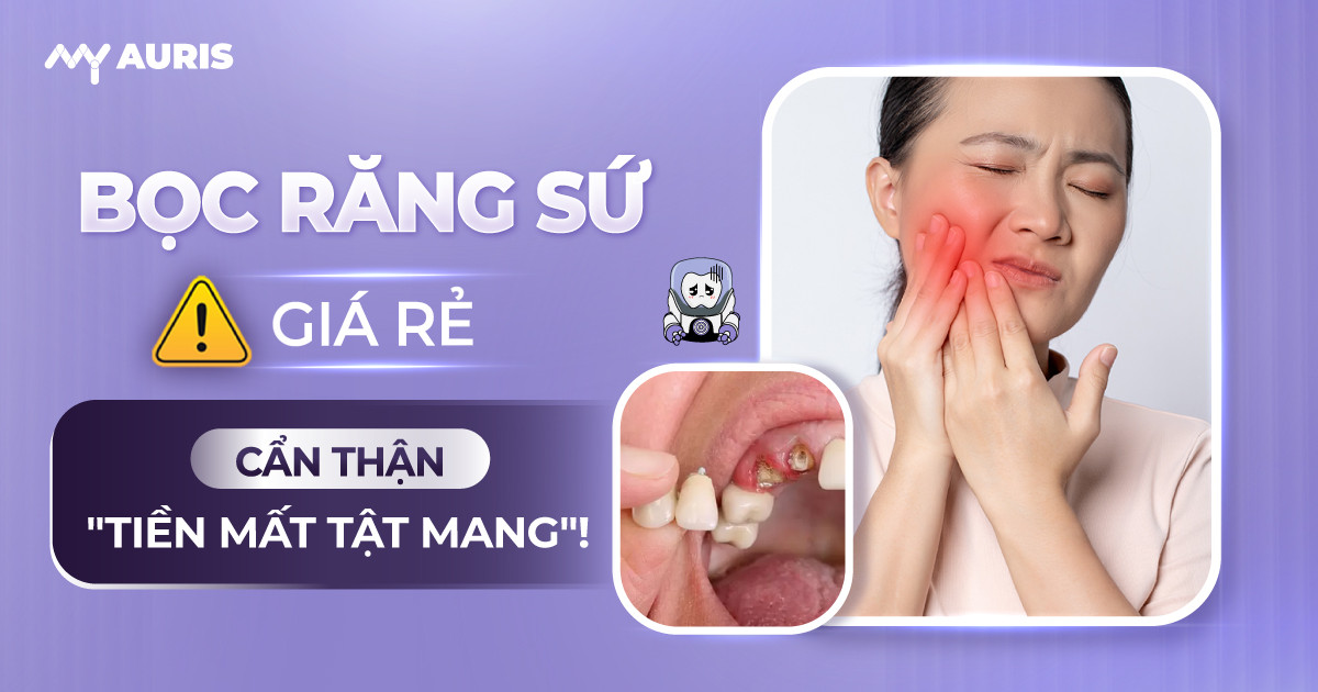 bọc răng sứ giá rẻ, răng sứ giá rẻ