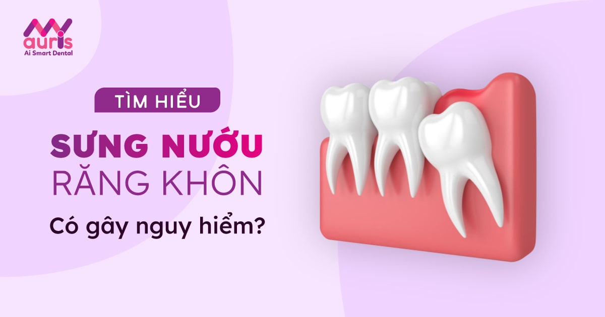 Sưng nướu răng khôn là gì? Cách trị sưng nướu răng khôn