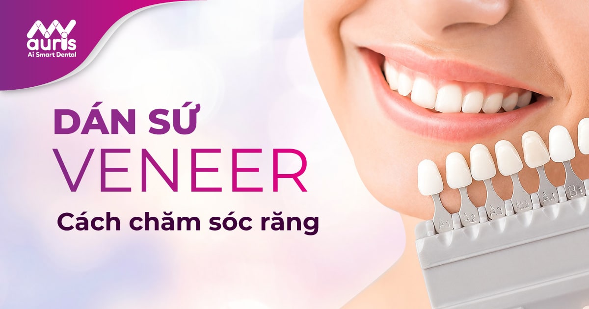 Dán sứ veneer có bền không?