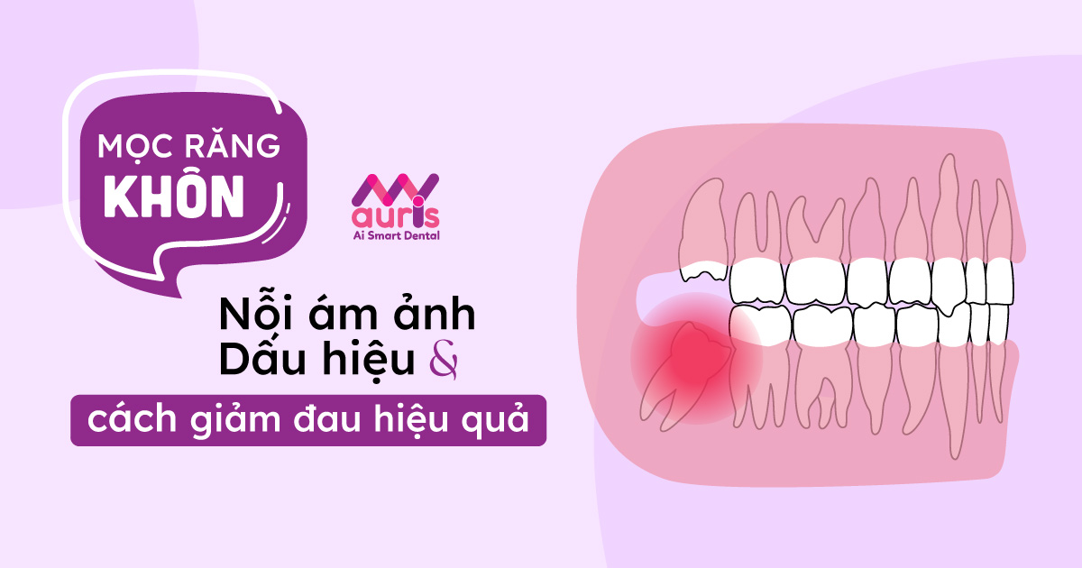 dấu hiệu mọc răng khôn và những biến chứng răng khôn mọc lệch