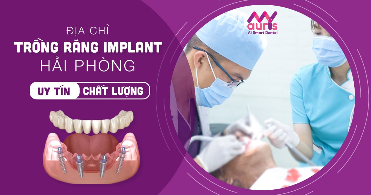 Trồng răng implant hải phòng ở đâu tốt?