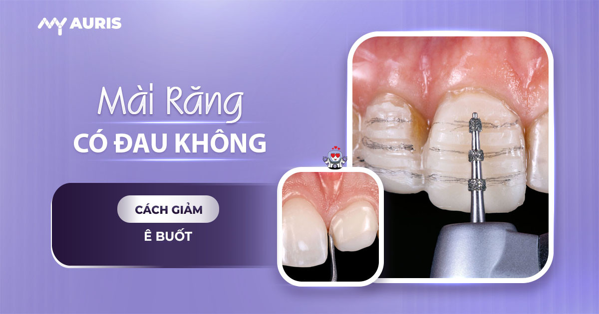 mài răng có đau không,mài răng xong bị ê buốt
