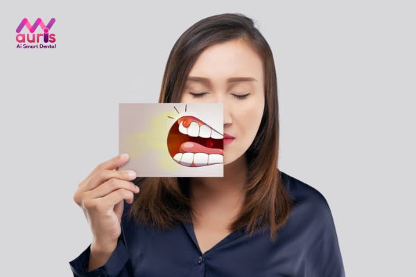 Viêm nướu răng (lợi) là gì?