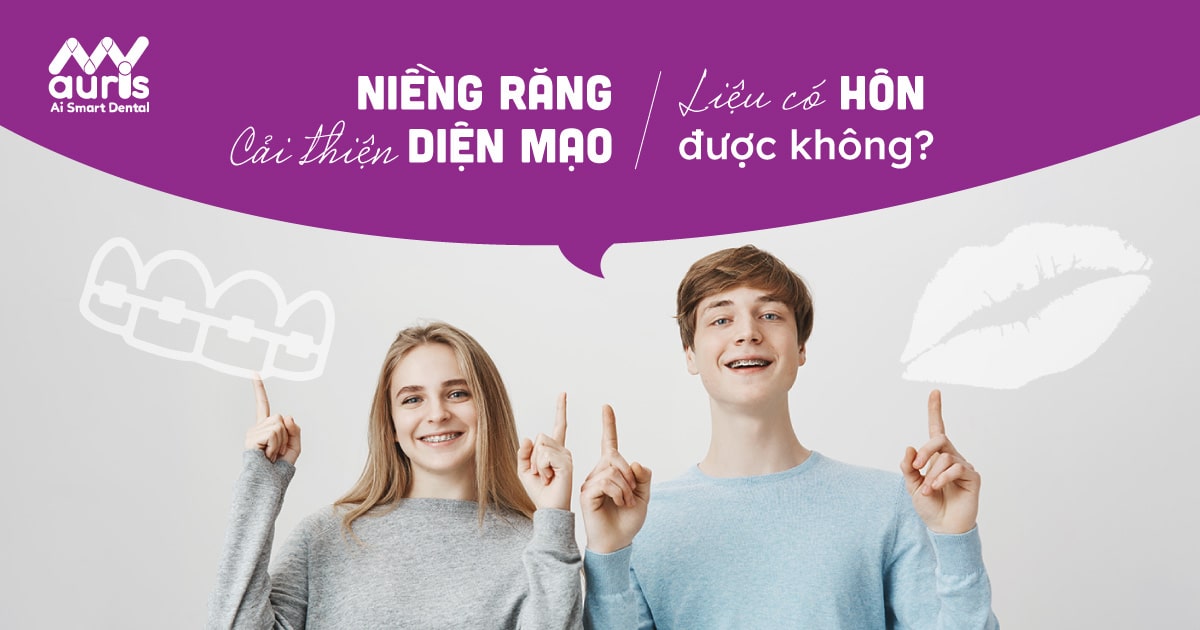 Niềng răng có hôn được không?