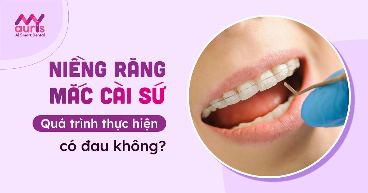 Niềng răng mắc cài sứ có đau không?