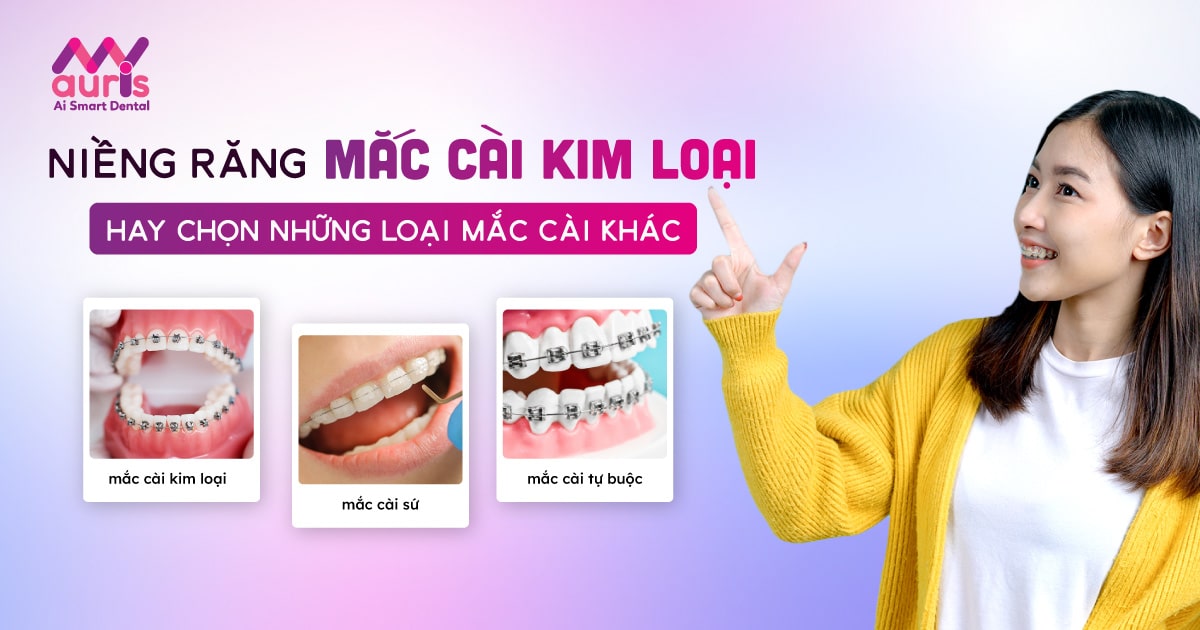 Niềng răng pha lê có thể điều chỉnh được độ căng của mắc cài không?
