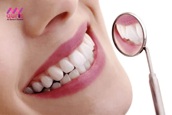 Răng sứ Lumineers là gì?