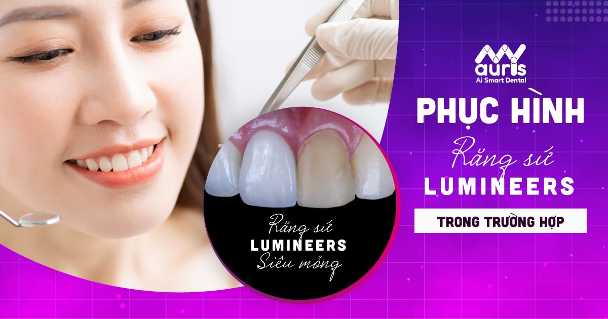 Phục hình bằng răng sứ Lumineers siêu mỏng không cần mài răng