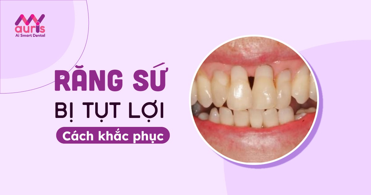 Nguyên nhân và cách khắc phục khi răng sứ bị tụt lợi