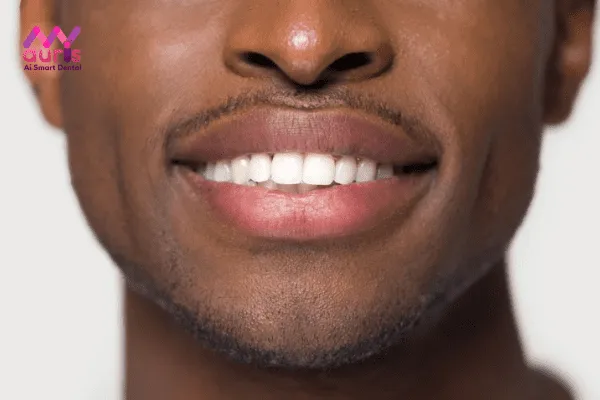 Tẩy trắng răng sứ có ảnh hưởng gì ko?
