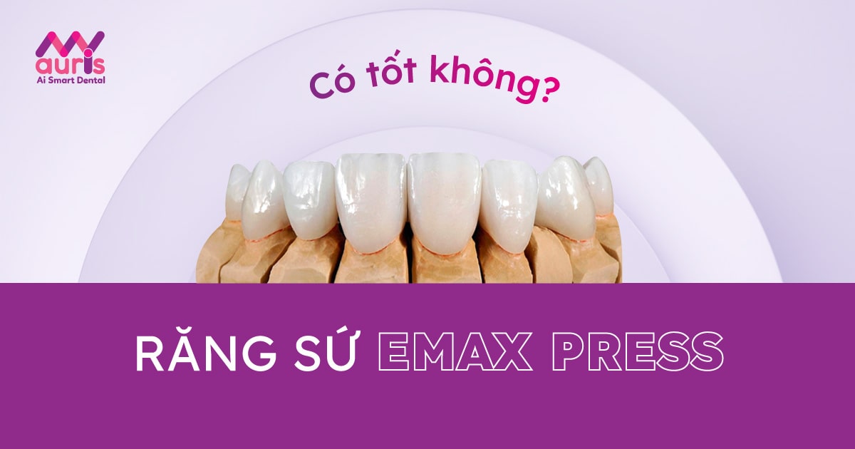 Răng sứ thủy tinh Emax press – Đỉnh cao của công nghệ làm răng sứ