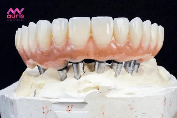 Quy trình phục hình răng sứ Emax Zirconia