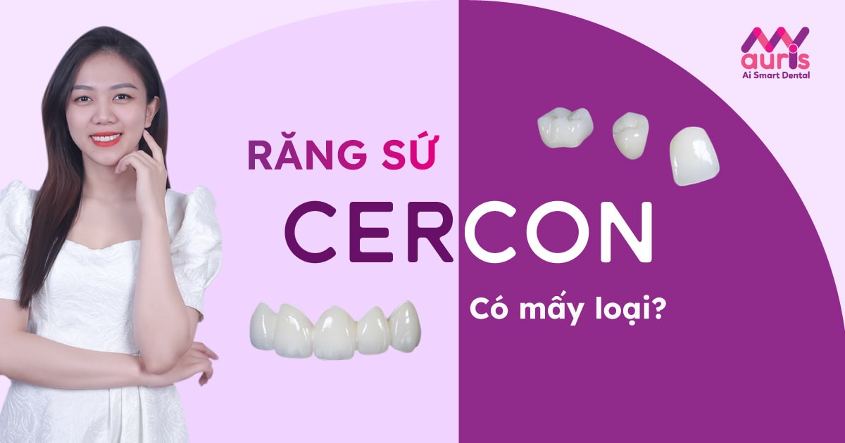 Răng sứ Cercon có màu sắc tự nhiên và hòa hợp với môi trường miệng không?
