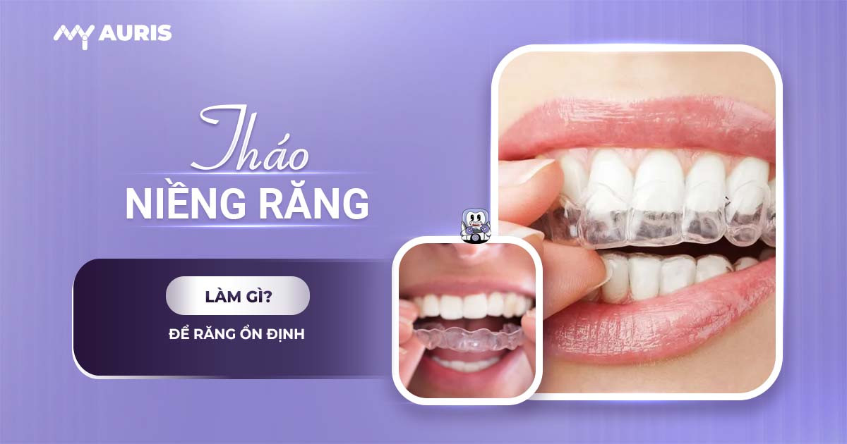 sau khi tháo niềng răng nên làm gì