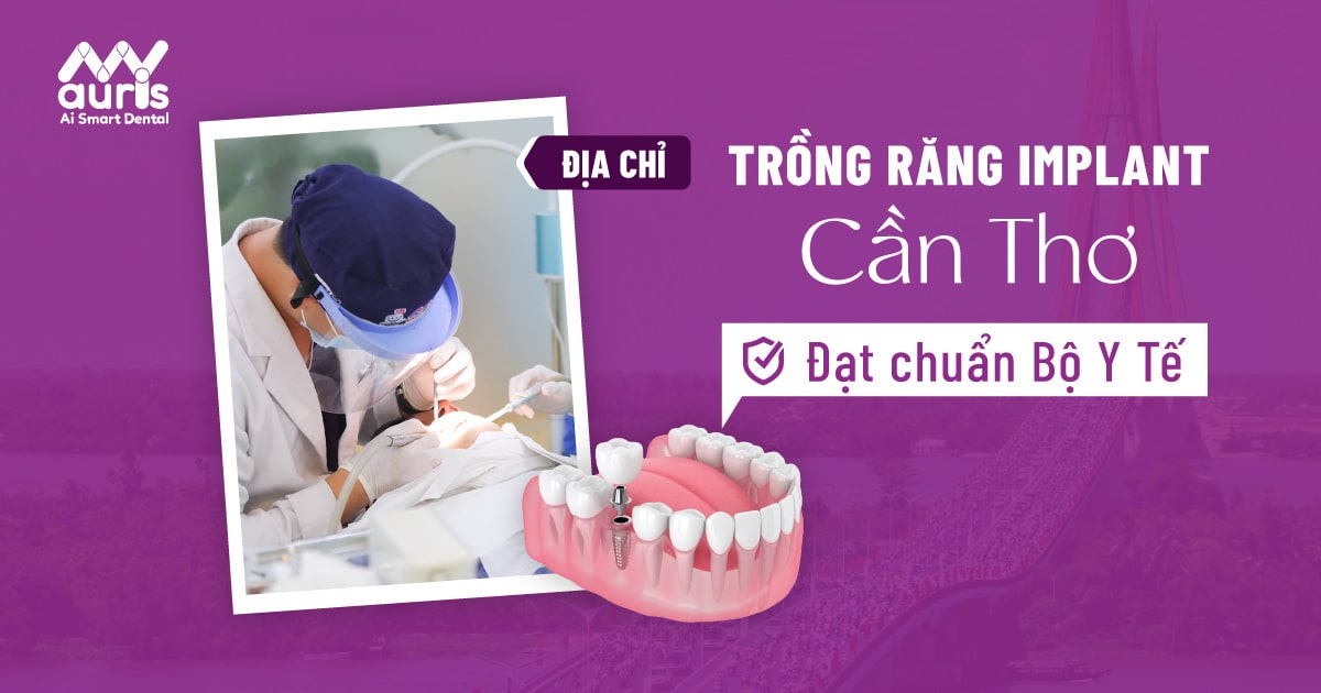 Giải pháp trồng răng implant cần thơ đạt chuẩn của bộ y tế