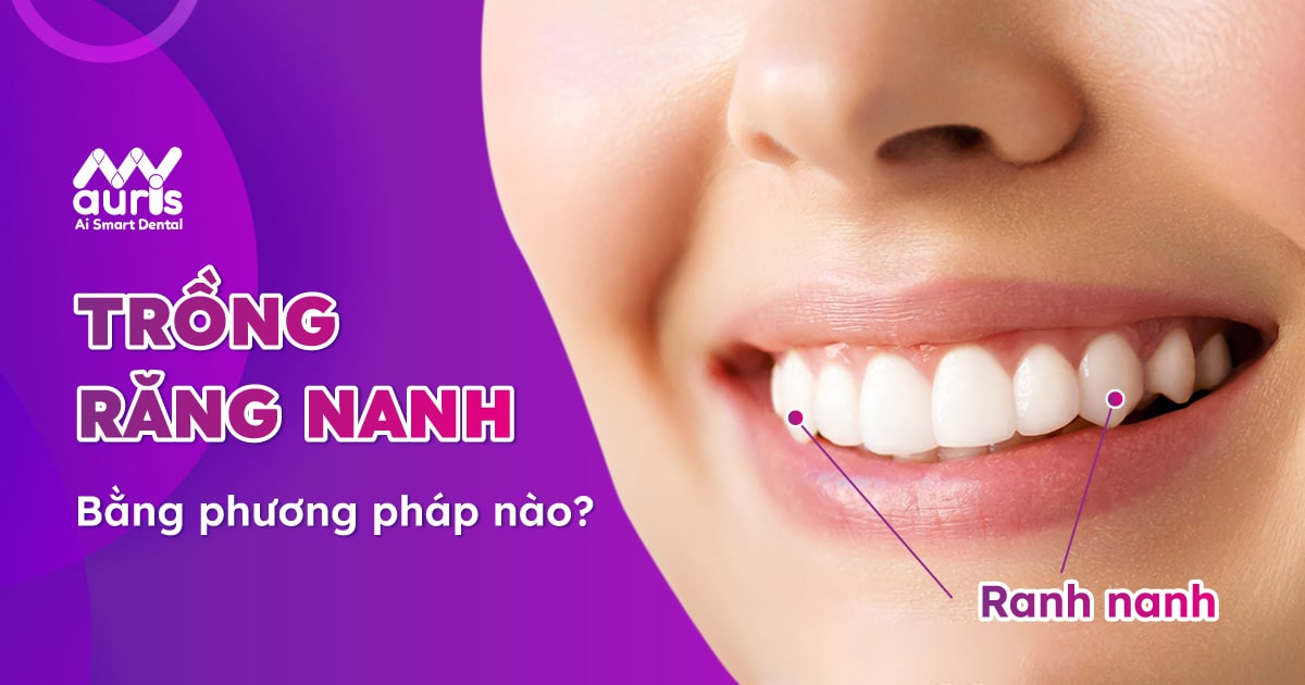 Trồng răng nanh hết bao nhiêu tiền?