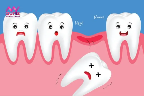 Nguyên nhân và hậu quả khi bị mất răng nguyên hàm