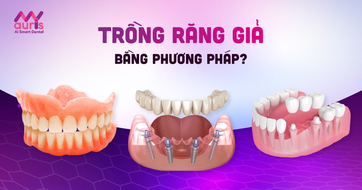 Trồng răng giả nguyên hàm bằng Implant