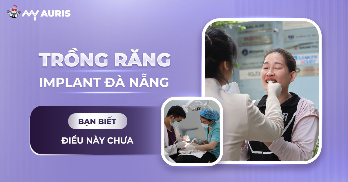 trồng răng implant đà nẵng,trồng răng implant tại đà nẵng