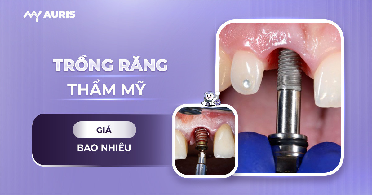 Trồng răng thẩm mỹ giá bao nhiêu