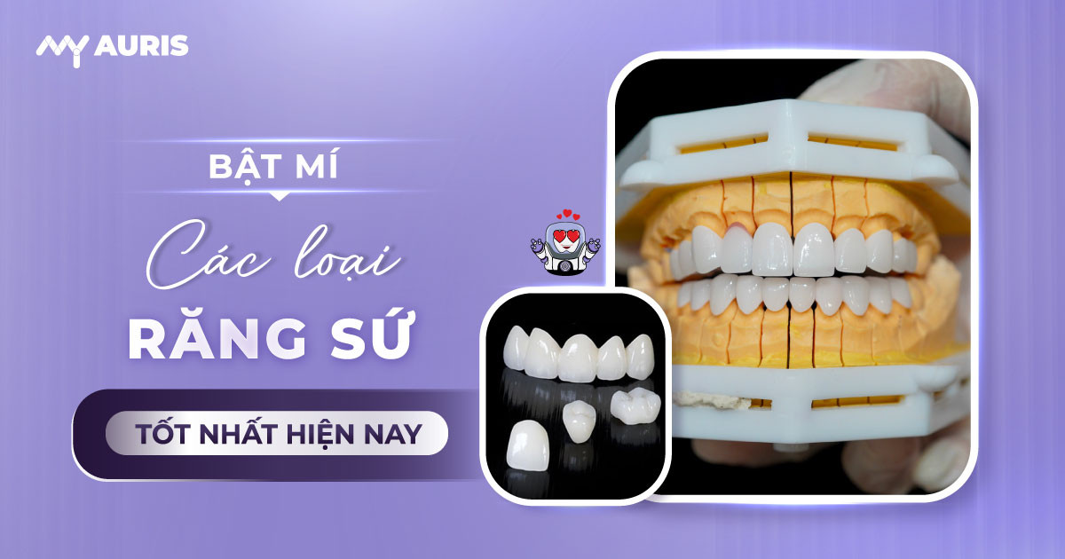 các loại răng sứ tốt nhất hiện nay,răng sứ cao cấp