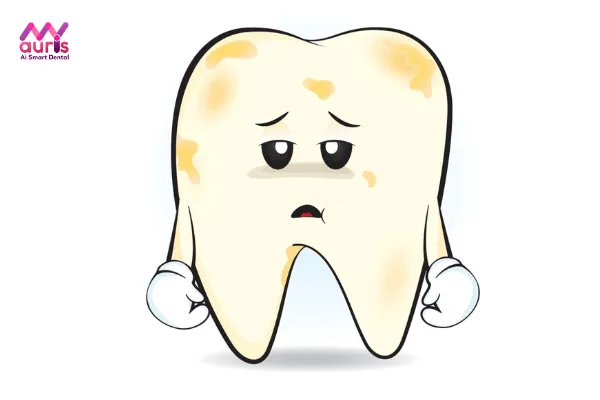 Răng bị vàng, xuất hiện lỗ li ti có tẩy trắng được không? 