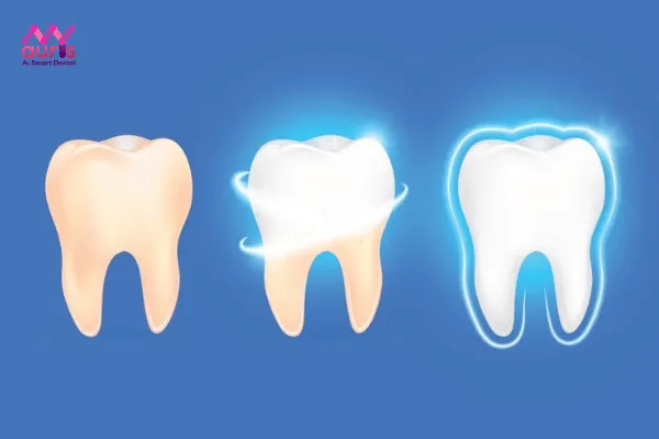 Tẩy trắng răng có ê buốt không? 