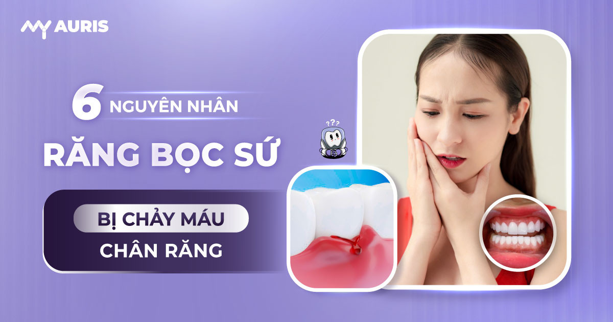 làm răng sứ bị chảy máu chân răng