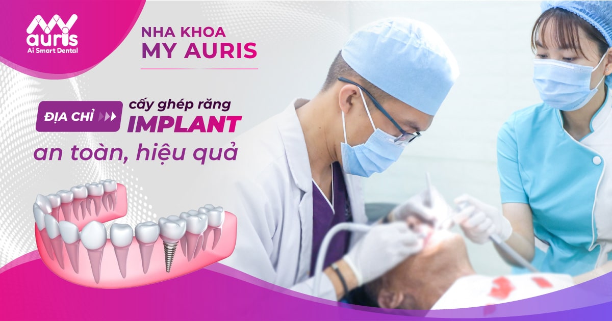 NHA KHOA MY AURIS - địa chỉ cấy ghép răng implant an toàn, hiệu quả