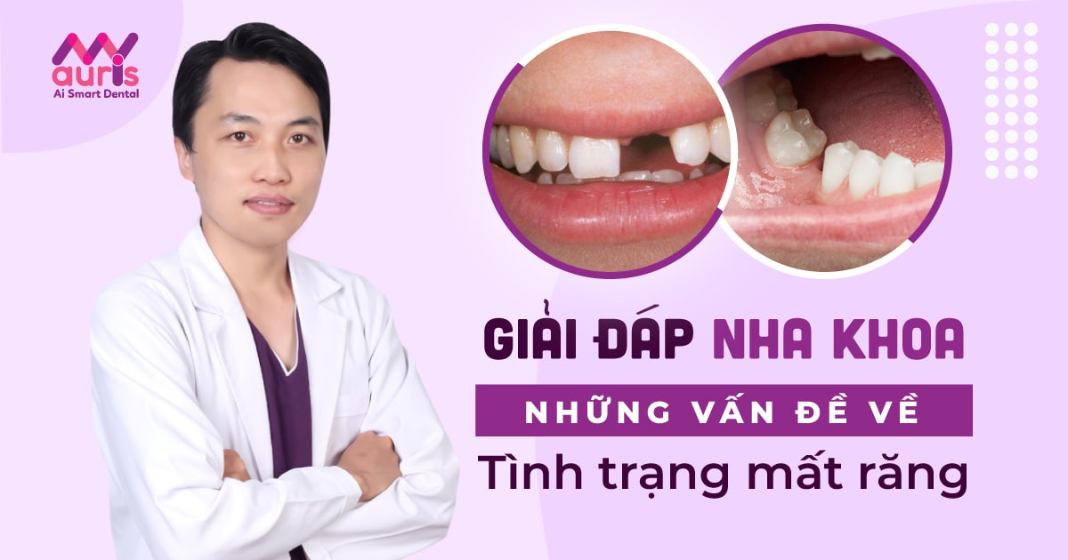 những vấn đề về tình trạng mất răng