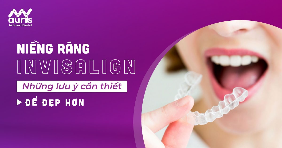 Những lưu ý khi niềng răng invisalign