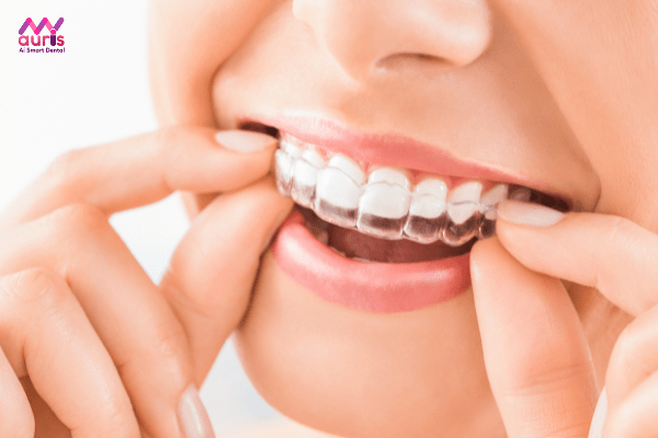 Niềng răng invisalign địa chỉ nào tốt?