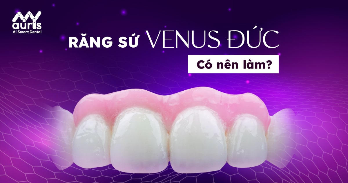 Răng sứ venus đức có tốt không?