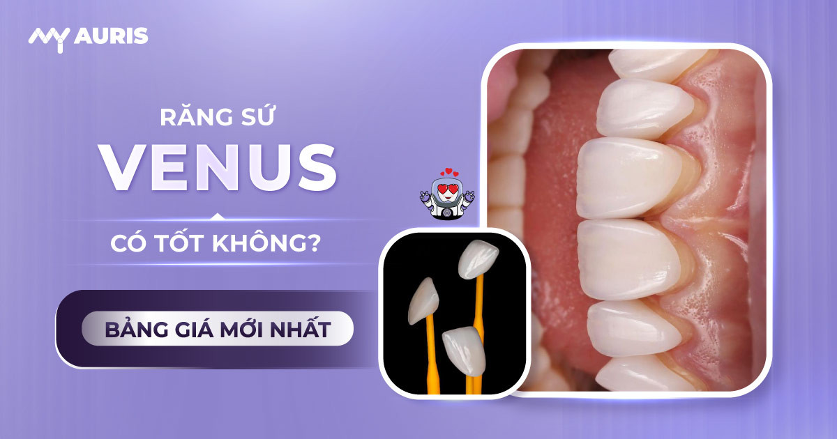 răng sứ venus, răng sứ venus đức có tốt không,răng venus đức