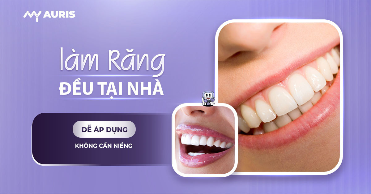 cách làm răng đều không cần niềng tại nhà