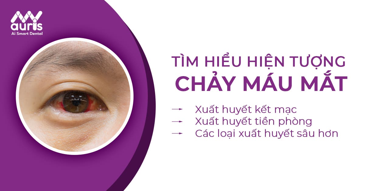 Chảy máu mắt có phải hiện tượng đáng lo ngại