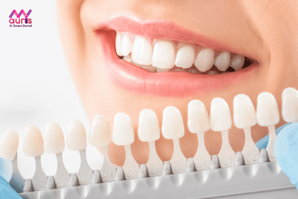 Lợi ích của việc làm răng sứ 