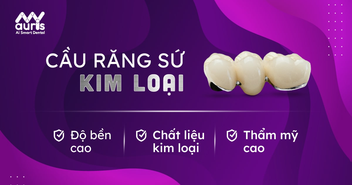 cầu răng sứ kim loại