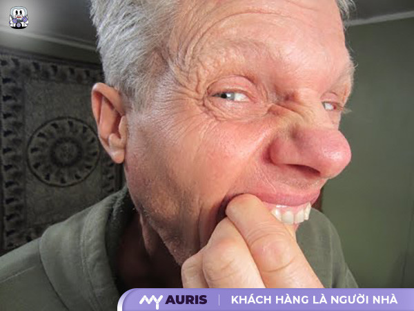 cách niềng răng thưa tại nhà