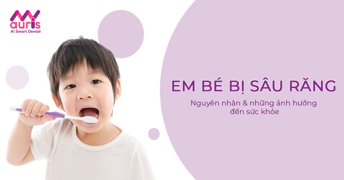 Em bé bị sâu răng - nguyên nhân và ảnh hưởng đến sức khỏe