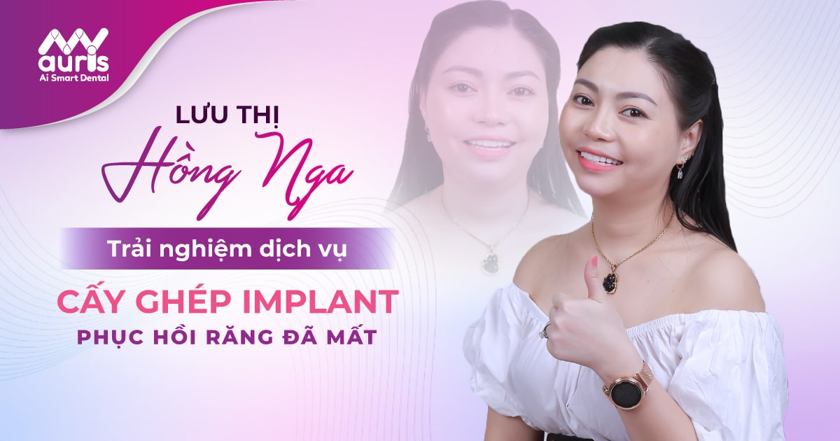 LƯU THỊ HỒNG NGA - Trải nghiệm cấy ghép implant phục hồi răng đã mất