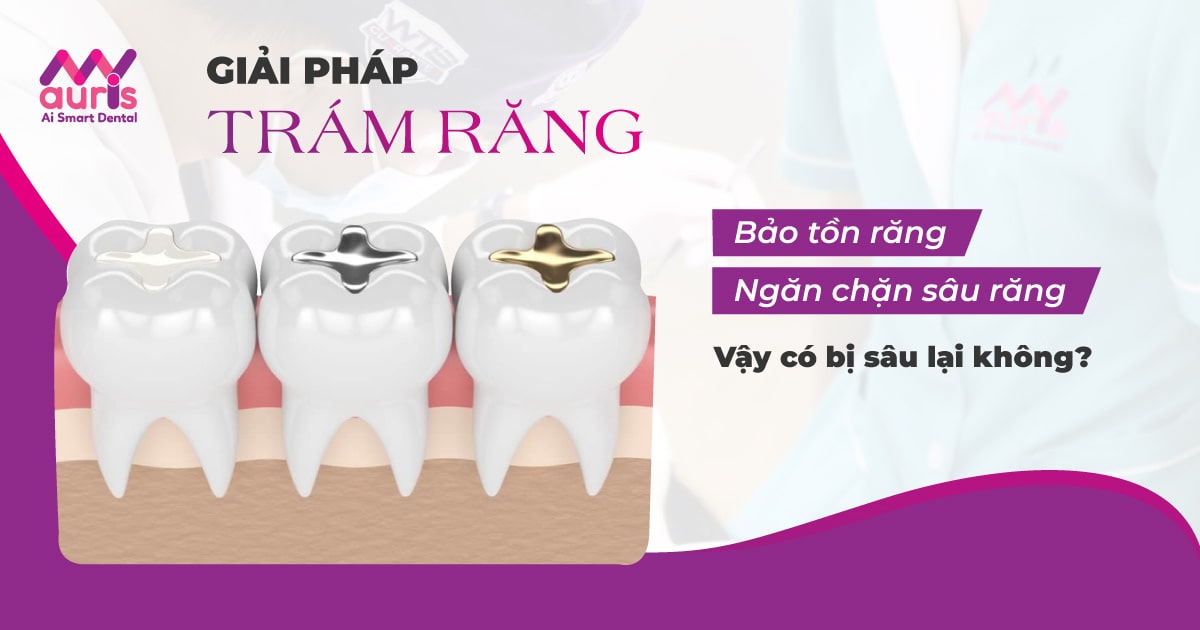 Nỗi lo trám răng có bị sâu trở lại không?