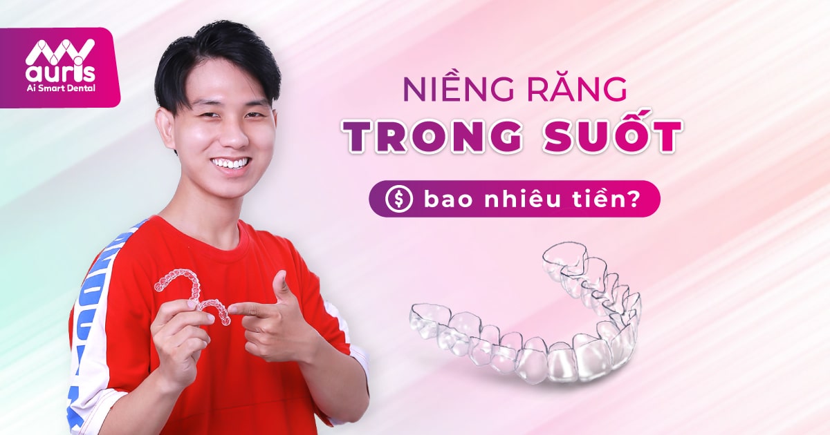 niềng răng trong suốt bao tiền