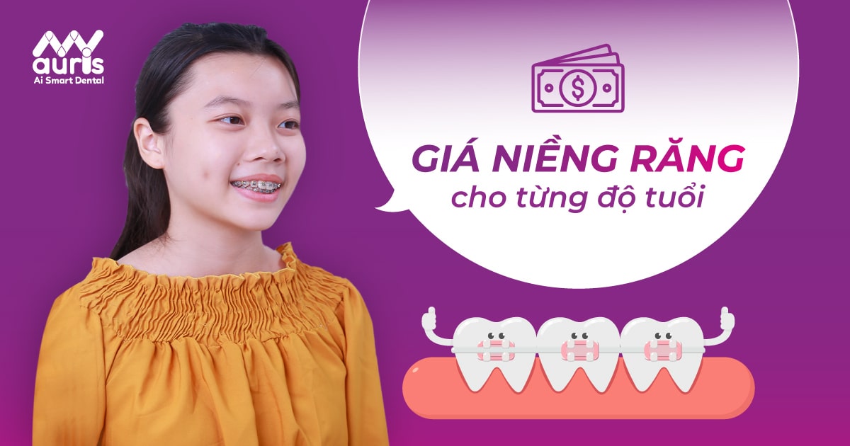 giá niềng răng cho trẻ 10 tuổi