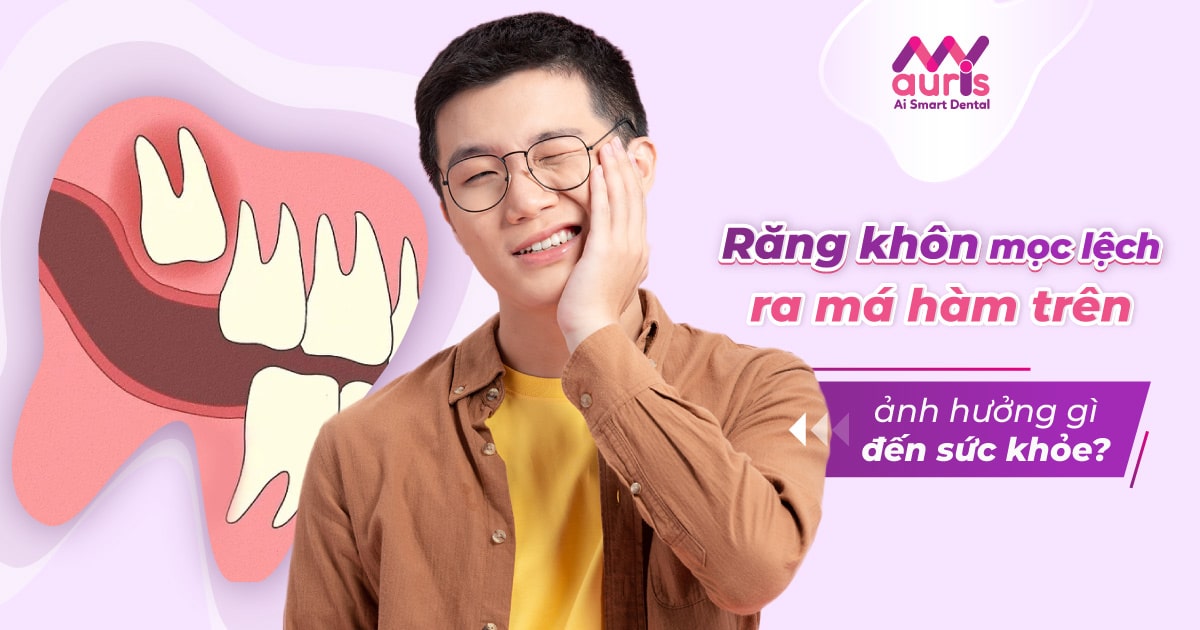 Răng khôn mọc lệch ra má hàm trên ảnh hưởng gì đến sức khỏe?