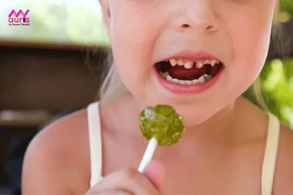 Dấu hiệu nhận biết răng cửa của bé 3 tuổi bị sâu 