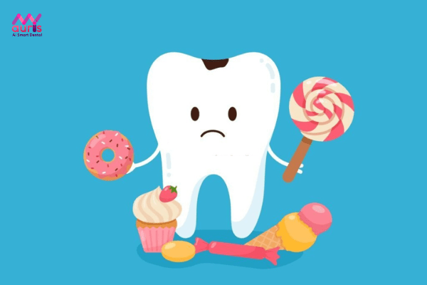 Nguyên nhân - bé 4 tuổi bị sâu răng hàm phải làm sao? 