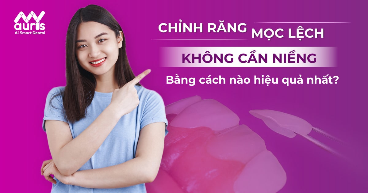 Cách chỉnh răng mọc lệch không cần niềng nào hiệu quả?